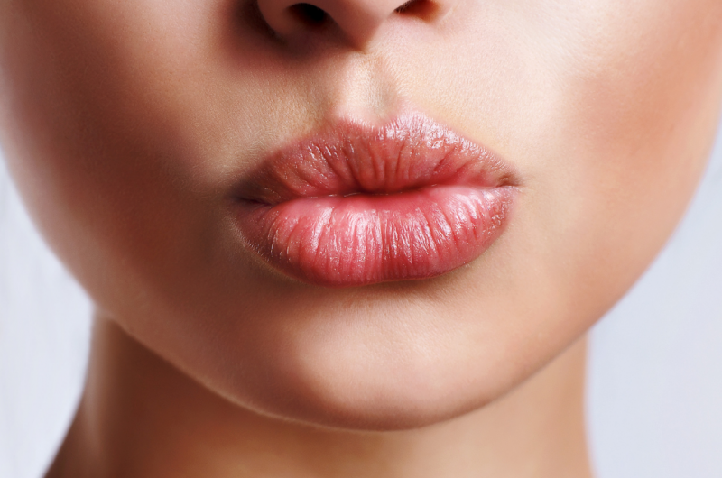 Tudo o que você precisa saber sobre preenchimento labial
